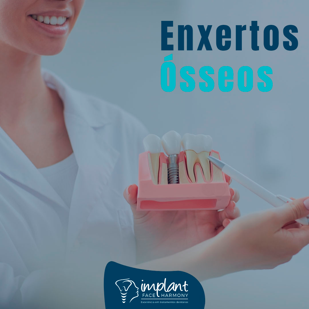 Enxertos Ósseos