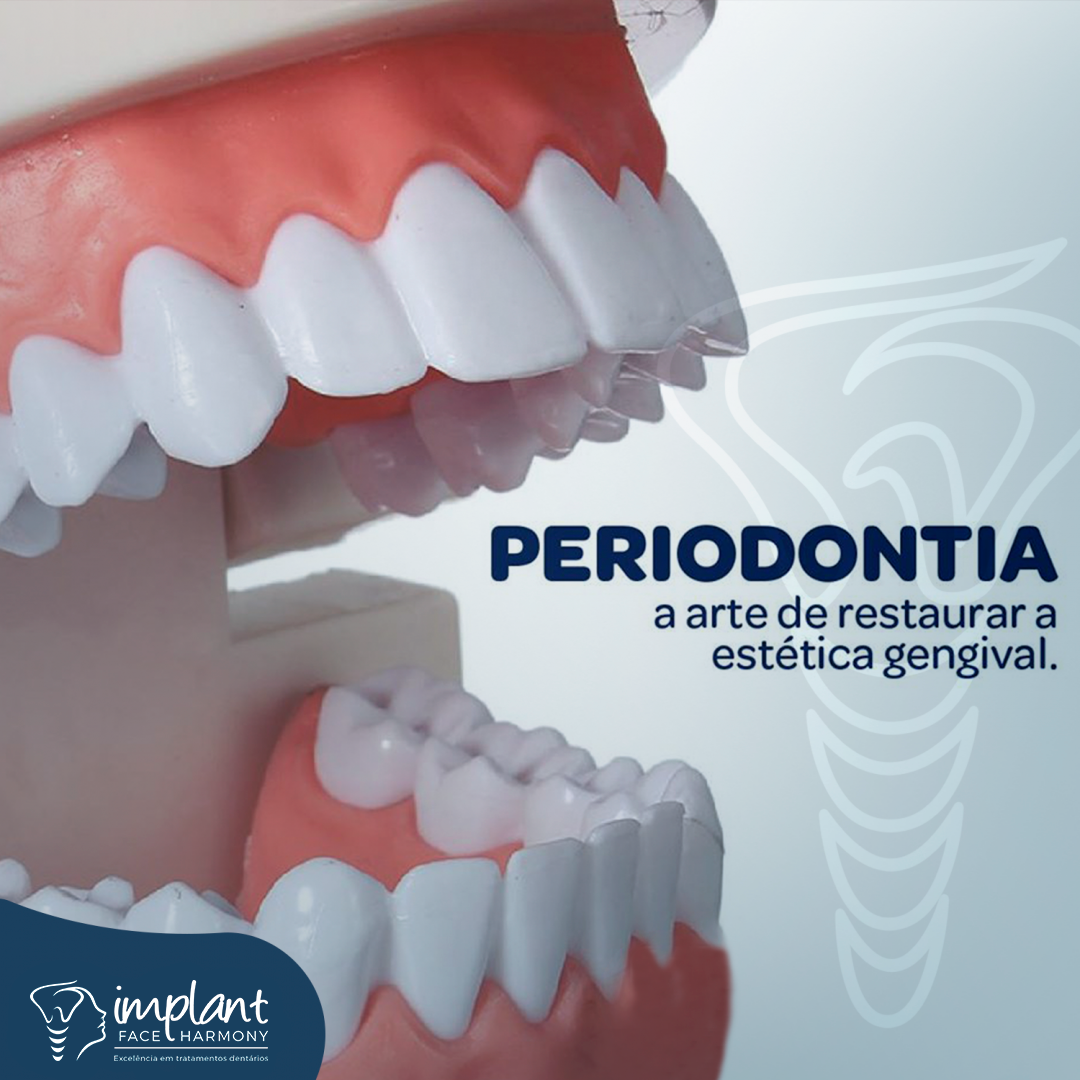 Periodontia Tratamento da Gengiva