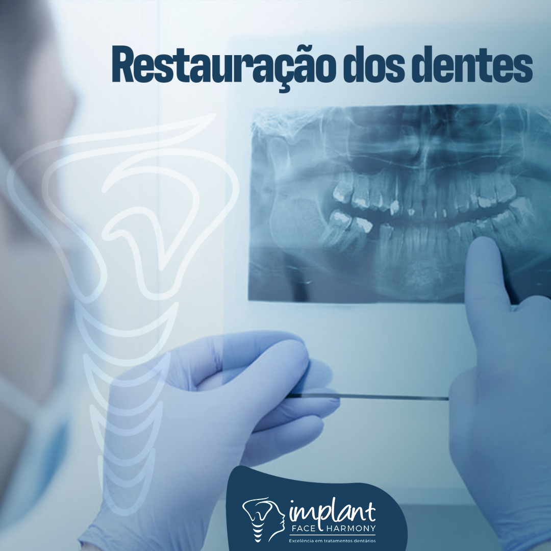 Restaurações