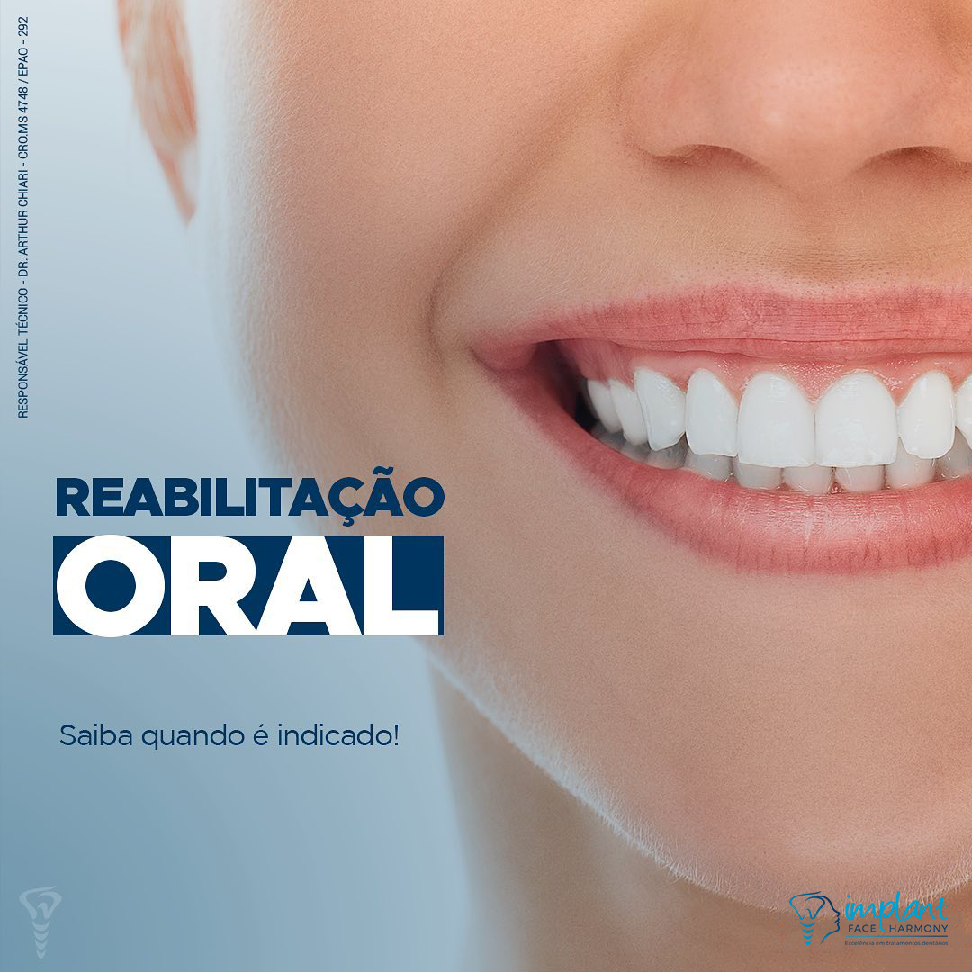 Reabilitação Oral Completa